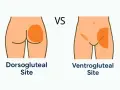 Vergleich von subkutan injektion orte: Dorsogluteal vs. Ventrogluteal. Illustration zeigt die Injektionsbereiche am Gesäß.