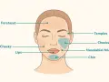 Gesichtspartien, die für Behandlungen wie Filler oder Botox in Frage kommen: Stirn, Schläfen, Wangen, Lippen, Nasolabialfalten und Kinn. Hier wird gezeigt, wohin spritzen.