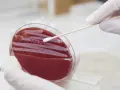 Ein Wattestäbchen wird über eine Agarplatte mit roten Kolonien geführt, um einen MRSA-Test durchzuführen.