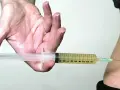 Hand hält Spritze mit gelber Flüssigkeit, bereit zur Injektion. Mögliche Verkapselung nach Thrombosespritze.