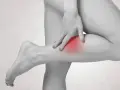 Frau berührt schmerzende Wade, ein mögliches Warnzeichen für eine Venenthrombose.