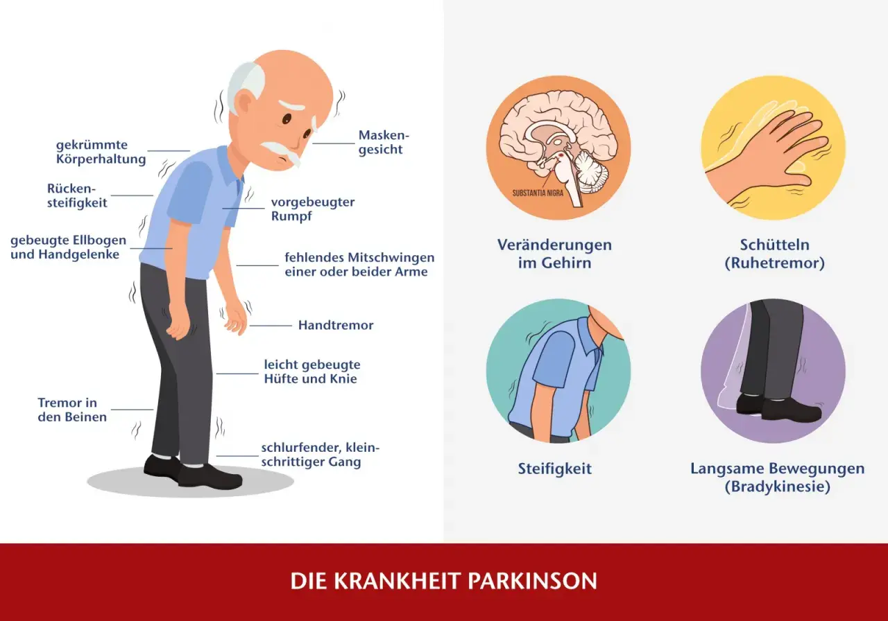 Die Diagnose von Parkinson erfolgt anhand von Symptomen wie Tremor, Steifigkeit und langsamen Bewegungen. Das Bild zeigt diese Anzeichen.
