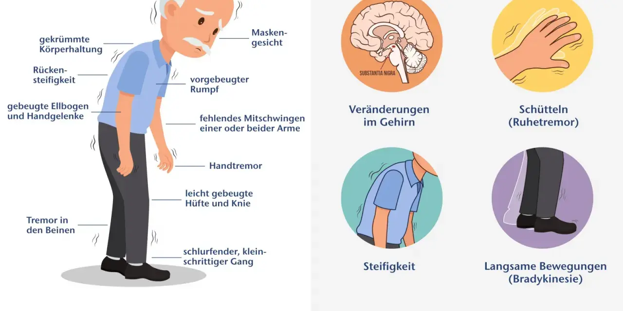 Die Diagnose von Parkinson erfolgt anhand von Symptomen wie Tremor, Steifigkeit und langsamen Bewegungen. Das Bild zeigt diese Anzeichen.