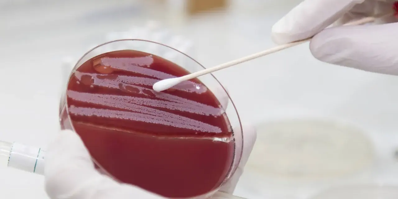 Ein Wattestäbchen wird über eine Agarplatte mit roten Kolonien geführt, um einen MRSA-Test durchzuführen.