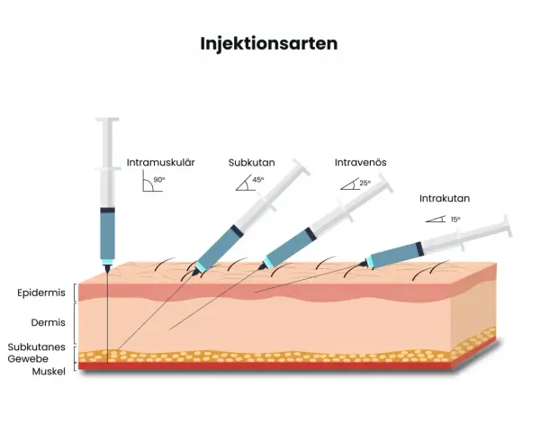 Illustration zeigt verschiedene Injektionsarten: intramuskulär (90°), subkutan (45°), intravenös (25°) und intrakutan (15°), um zu zeigen, wie man weiter spritzen kann.