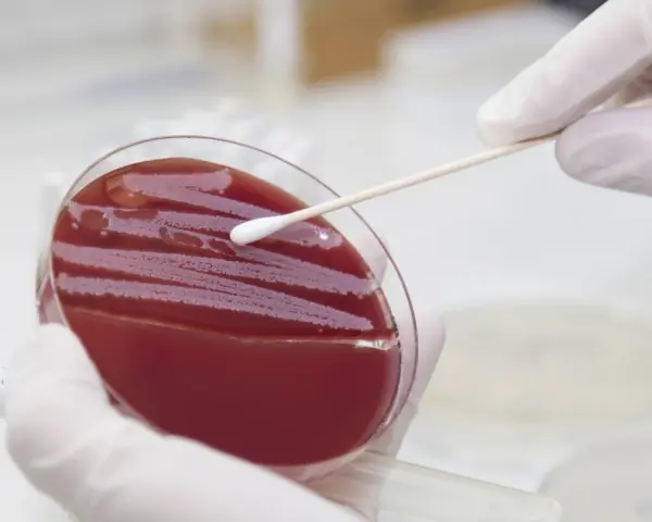 Ein Wattestäbchen wird über eine Agarplatte mit roten Kolonien geführt, um einen MRSA-Test durchzuführen.
