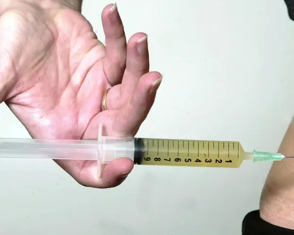 Hand hält Spritze mit gelber Flüssigkeit, bereit zur Injektion. Mögliche Verkapselung nach Thrombosespritze.