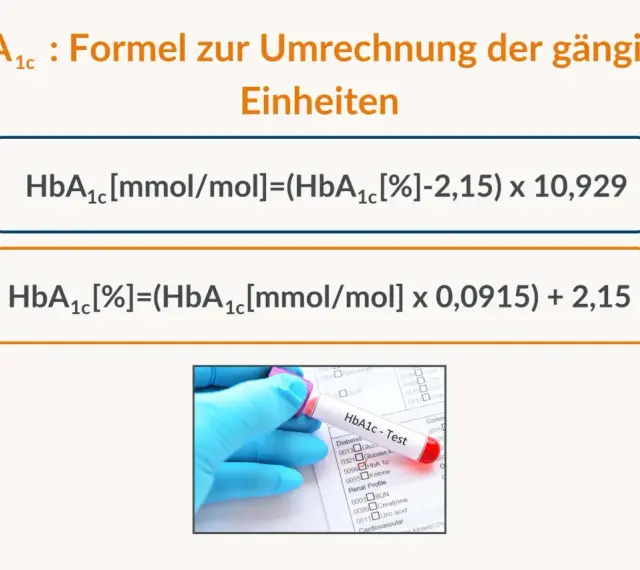 Formeln zur Umrechnung von HbA1c-Werten, wichtig für die Überwachung von Diabetes normwerte. Ein Laborröhrchen mit "HbA1c - Test" ist zu sehen.