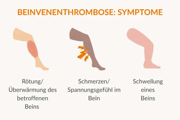 Rötung, Schmerzen und Schwellung am Bein sind Symptome, die auf eine Thrombose hinweisen können. Achte auf diese Anzeichen!