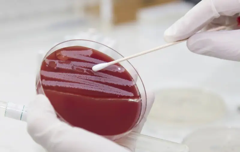 Ein Wattestäbchen wird über eine Agarplatte mit roten Kolonien geführt, um einen MRSA-Test durchzuführen.